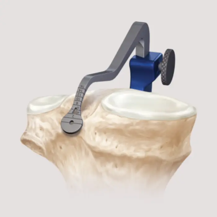 ACL Reconstruction Surgeon in Chennai, ACL Surgery in Adyar | Besant ...